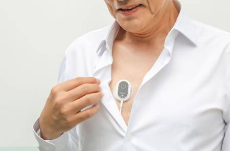 씨어스, 웨어러블 AI심전도 ‘모비케어’ 사용 50만건 돌파 “온기 흑전 청신호”