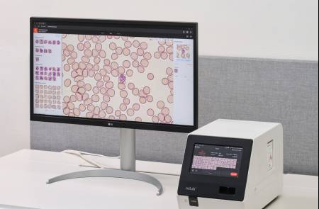 노을, 유럽 최대 규모 獨샤리테 병원에 마이랩 공급