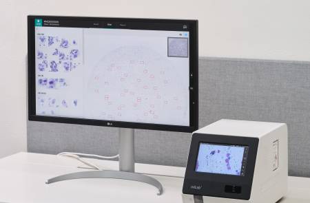 노을, 유럽 유통사 바이오메디카와 자궁경부암 진단 솔루션 공급 계약 체결